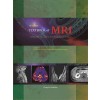 Textbook of MRI